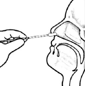 鼻拭子 收集的是前鼻甲的样本.