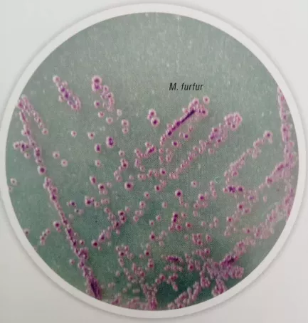 可引起皮肤角质层和毛囊感染的真菌 马拉色菌 威正翔禹生物