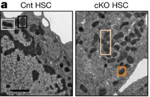 和对照(cnt)相比,自噬缺陷(cko)的hsc表现出线粒体堆积(电镜照片)